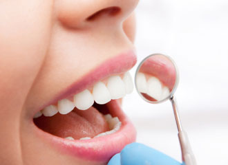 歯周病の確認