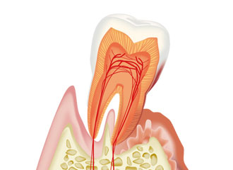 歯周組織を破壊する病気